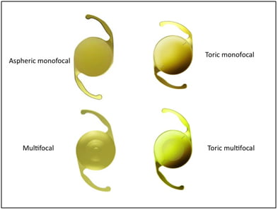 Figure 4 – Some examples of the different types of intraocular lenses available